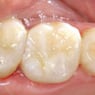 Drummoyne Laser Dental - Pic 5