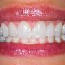 Yamanto Dental Surgery - Pic 6