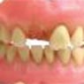 Affordable Denture Clinic - Pic 10