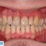 Affordable Denture Clinic - Pic 3