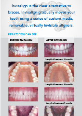 Results You Can See