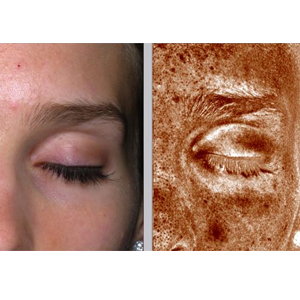 Preface Cosmetic Facial Surgery &amp; Laser - Cosmetic Surgery 