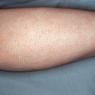 Geelong Hair Removal - Pic 4