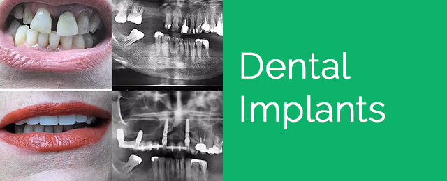 Benowa Mansions Periodontal Practice - Promotion 2