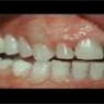 Affordable Denture Clinic - Pic 8