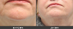South Coast Skin & Vein Clinic - Pic 7