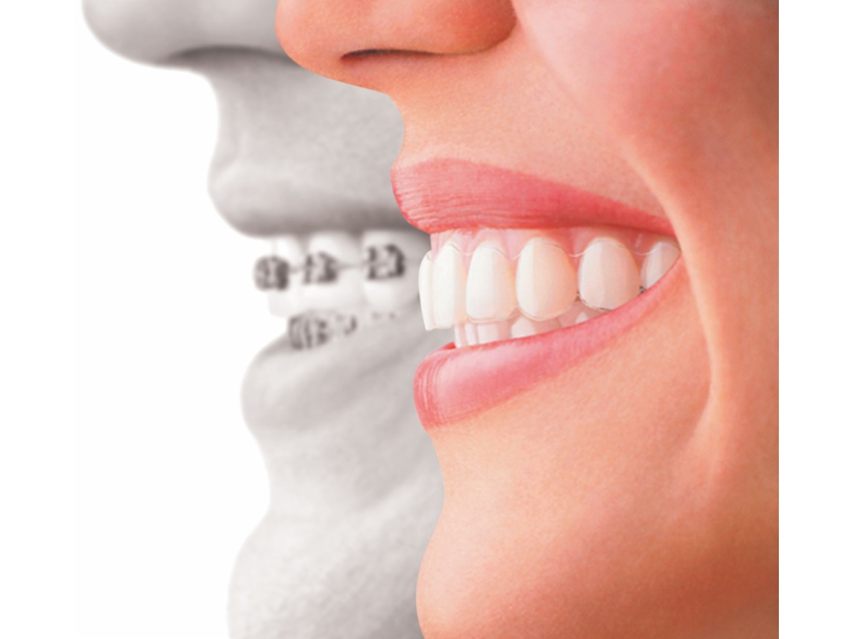 Toowoomba Orthodontists Orthodontist 301 Margaret St Toowoomba