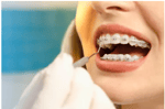 Huxtable Orthodontics - Pic 2