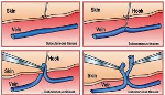 South Coast Skin & Vein Clinic - Pic 9