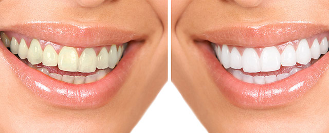 Yamanto Dental Surgery - Promotion 1