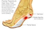 All Podiatry Services - Pic 4