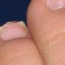 Lake Macquarie Podiatry - Pic 7