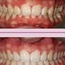Capital Smiles Orthodontist - Pic 8