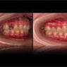 Affordable Denture Clinic - Pic 4