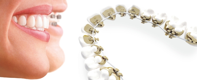 Smile Hawthorn - Promotion 3