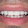 Braddon Dental Surgery - Pic 7