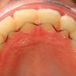 Hunter Valley Orthodontics - Pic 6