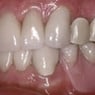 Drummoyne Laser Dental - Pic 8