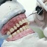 Total Denture Care Clinics - Pic 3