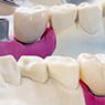 Bellerive Denture Clinic - Pic 9