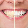 Braddon Dental Surgery - Pic 6